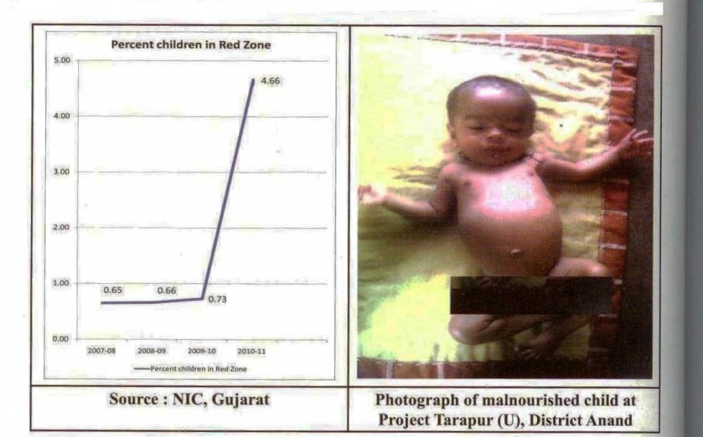 Photograph of Malnourished child - Press Note 07.03.2014